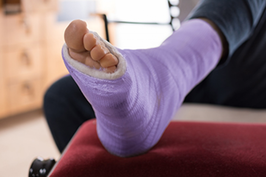 Stress Fractures of the Foot and Ankle 